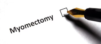 Laparoscopic Myomectomy Outpatient